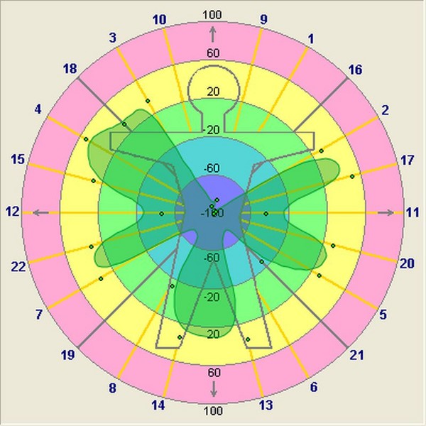 Naturheilpraxis Kerrin Olufs – AMSAT-Messung